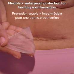 C-Section Silicone Scar Patches